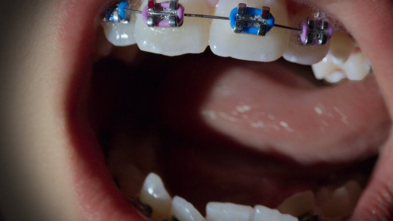 Thumbnail 11 von 11