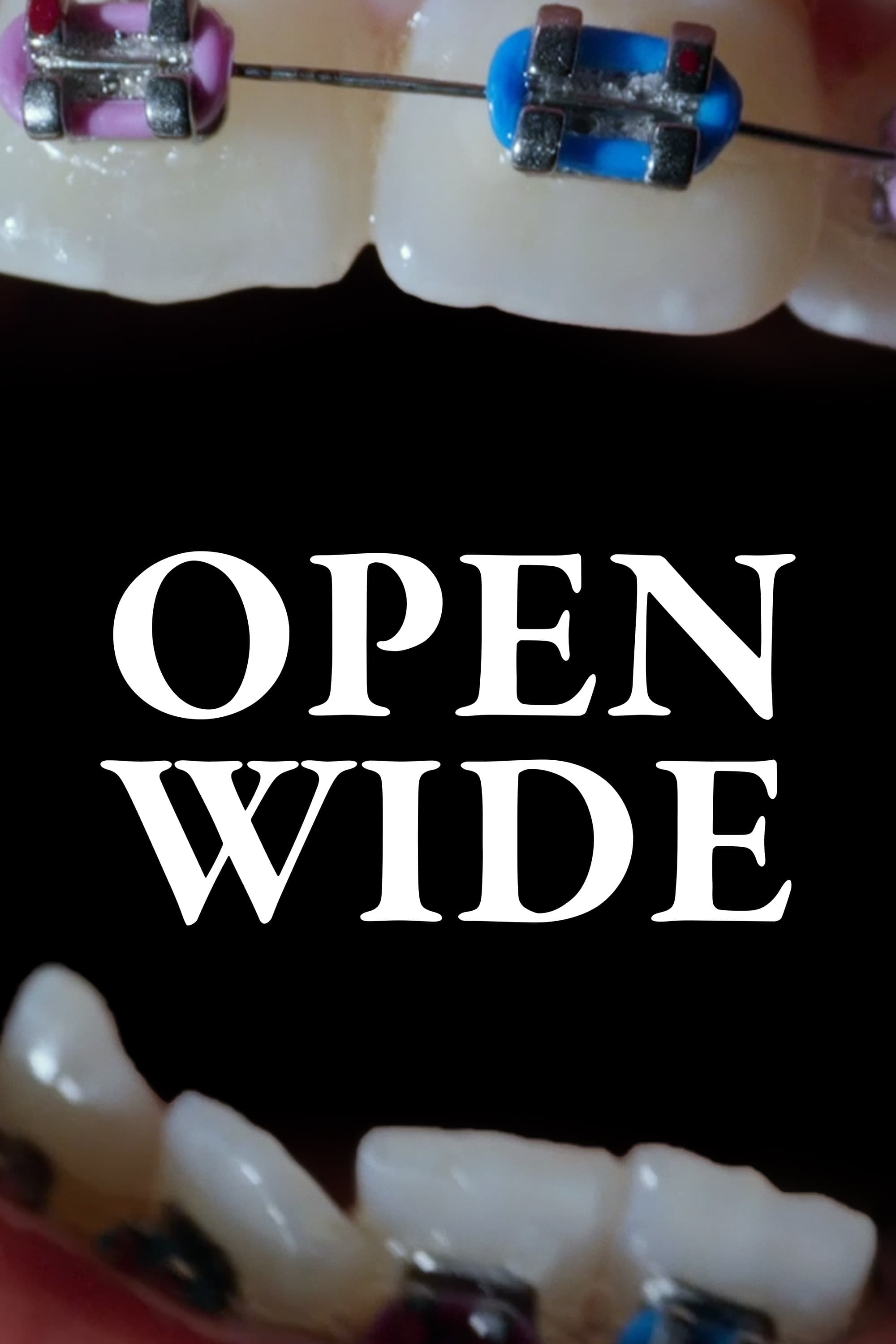Open Wide - Bild 1 von 11