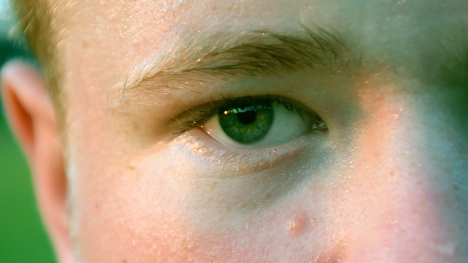 Thumbnail 10 von 11