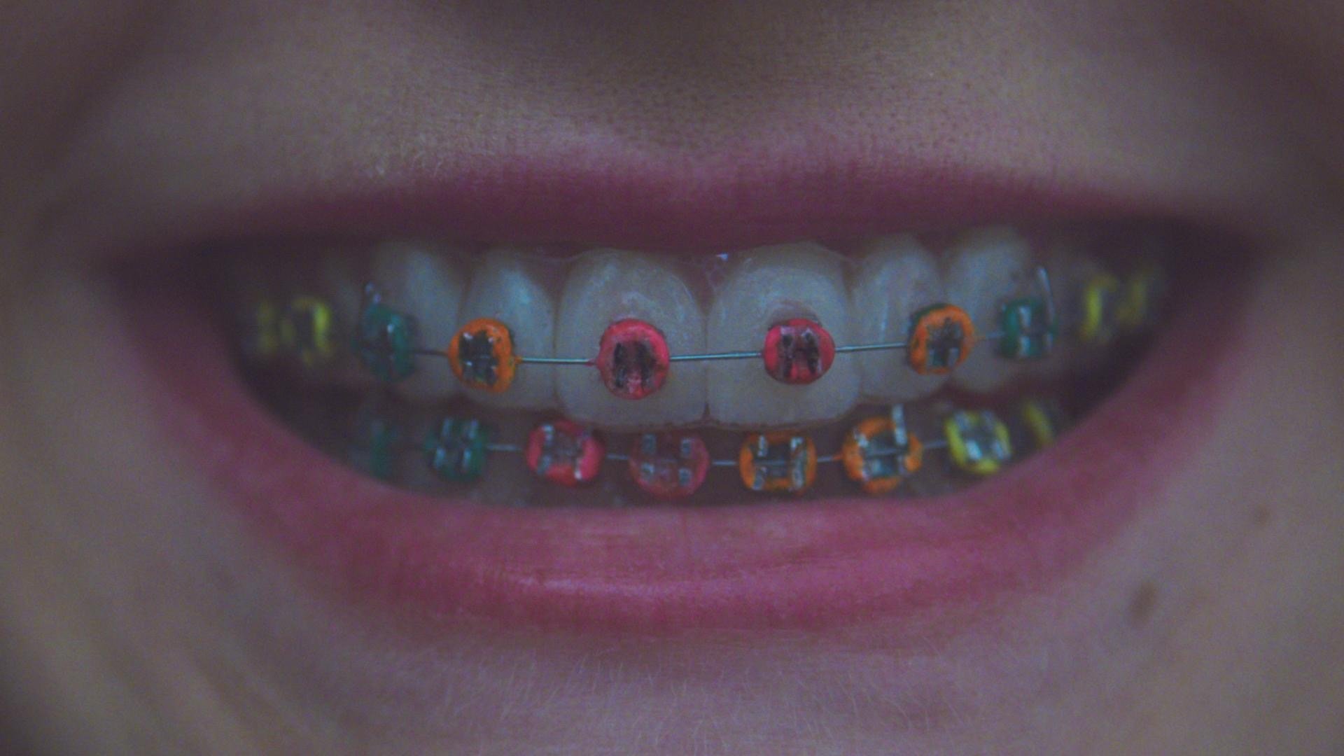 Thumbnail 3 von 7