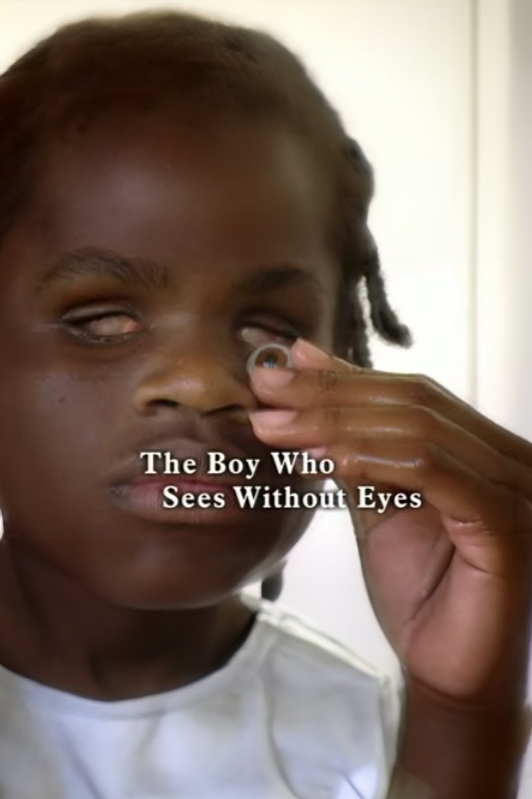 The Boy Who Sees Without Eyes - Bild 1 von 3