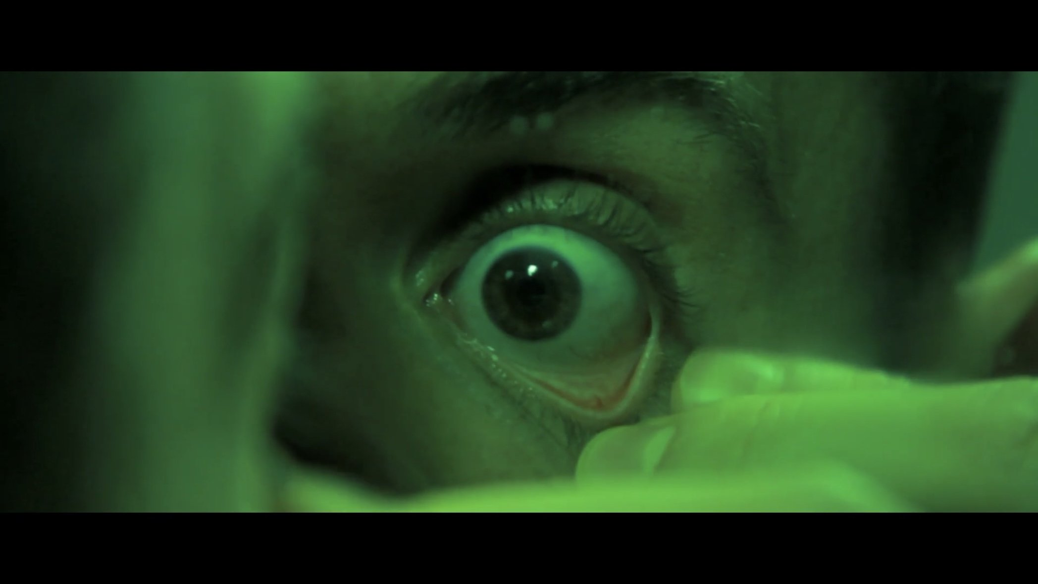 Thumbnail 4 von 5