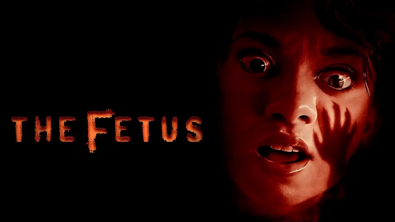 Thumbnail 2 von 11