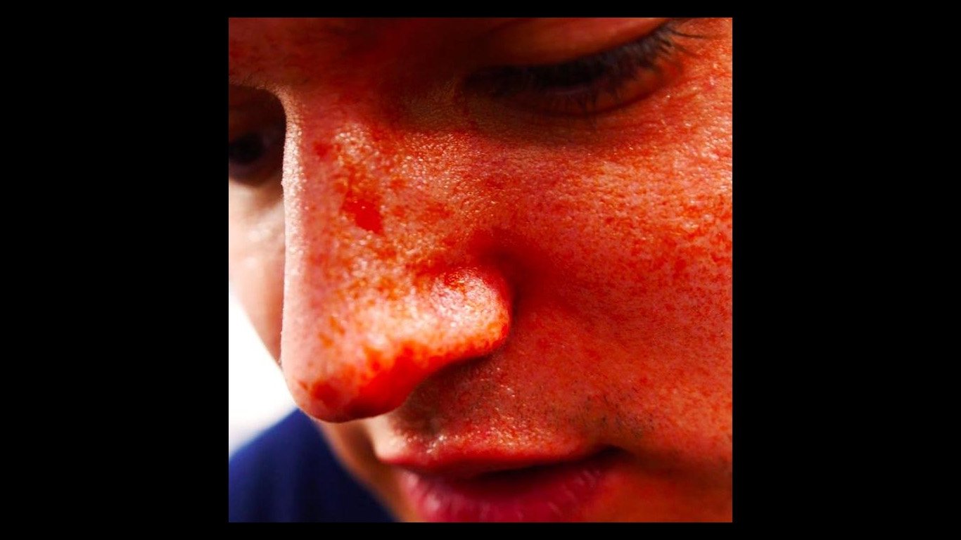 Thumbnail 3 von 4