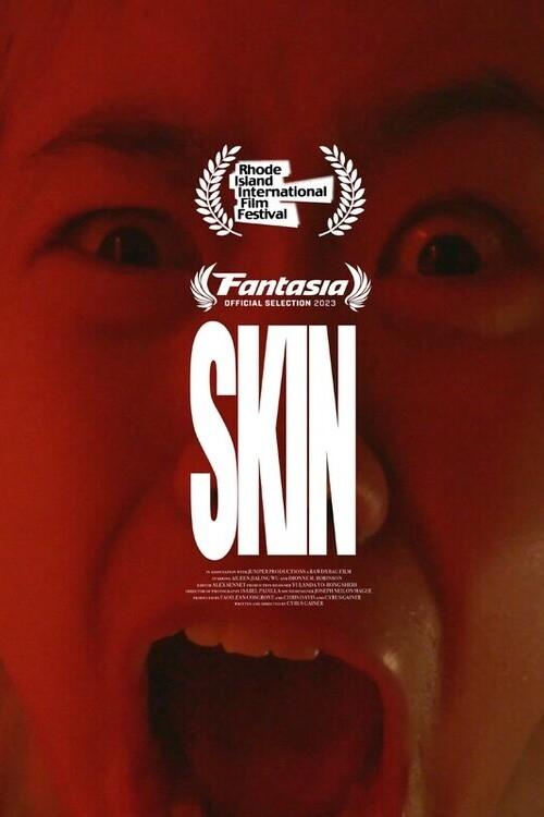 Skin - Bild 1 von 7