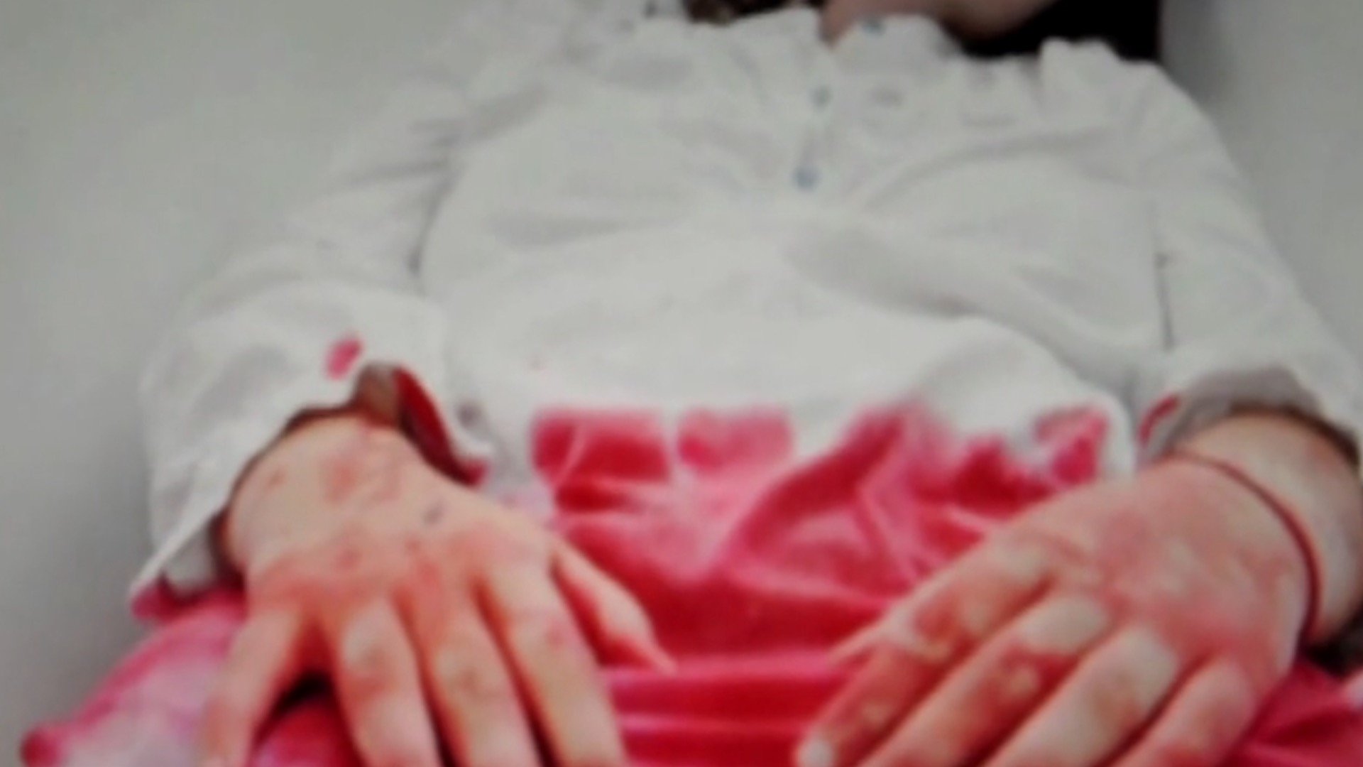 Thumbnail 2 von 3